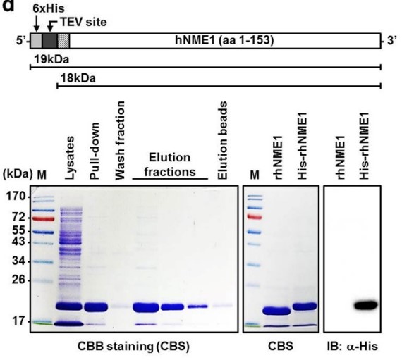 The schematic structure and production of rhNME1 or His-rhNME1 proteins.jpg
